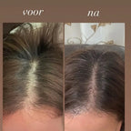 Selyven Exosoom Haar-groei Serum met Hoofdhuid Massageborstel