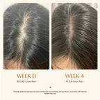 Selyven Exosome Hair Regrowth Serum with Scalp Massage Brush