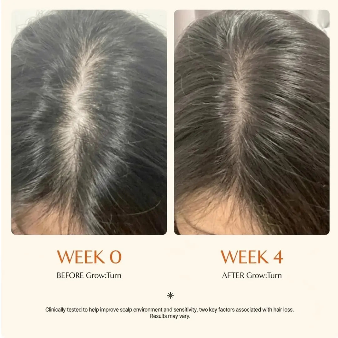 Selyven Exosome Hair Regrowth Serum with Scalp Massage Brush